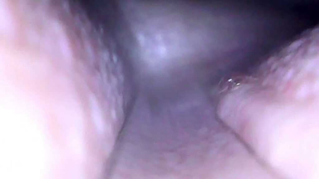 Close-up view of a soft tissue lining of a mouth with tones of pink and purple. The webcam image quality is somewhat low-resolution and somewhat blurry.